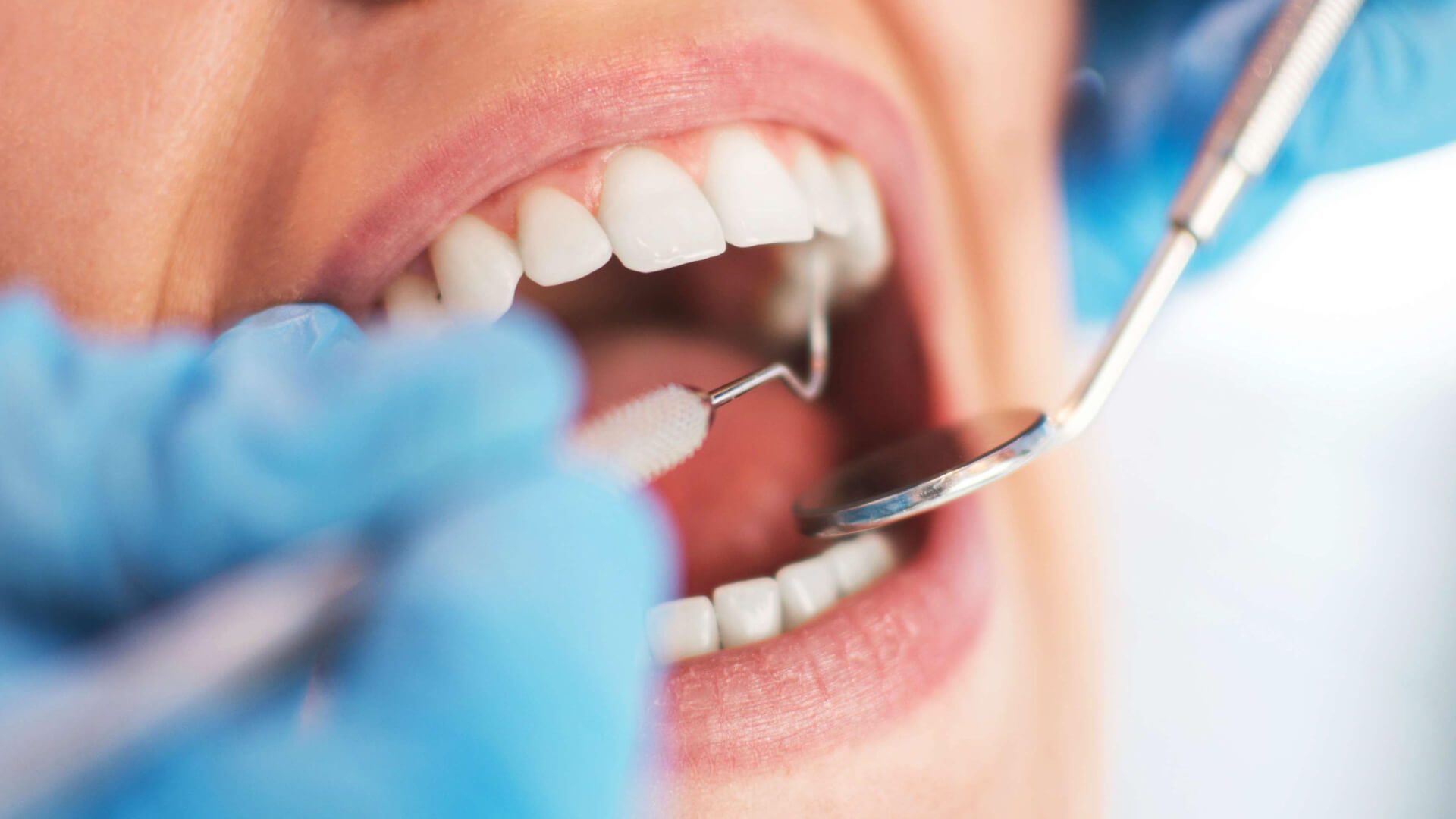 Dental Implants Treatment in Andheri